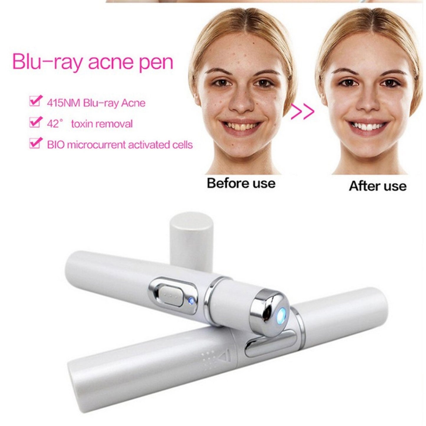 Wrinkle Removal Treatment Device Skin Care Beauty Equipment