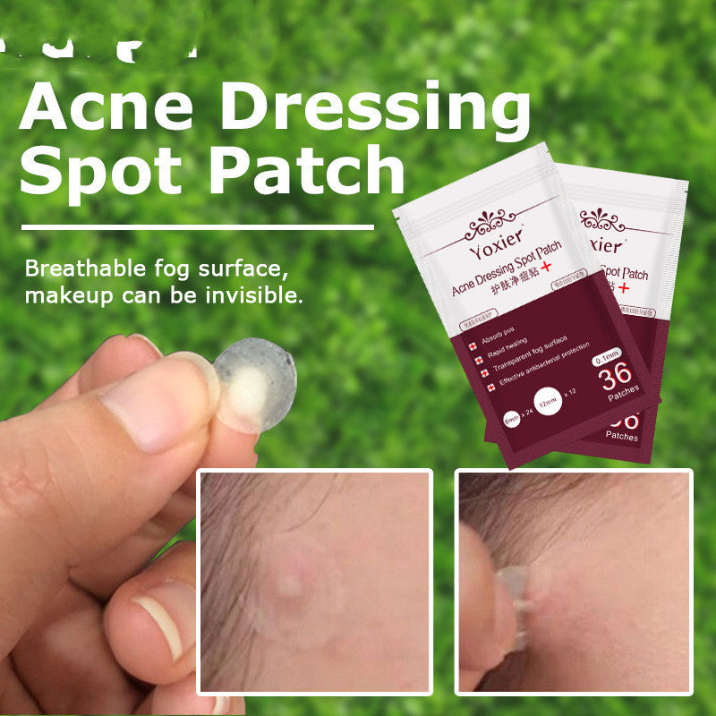 Blemish Treatment Invisible Acne Stickers Pimple Remover Set Face Cream