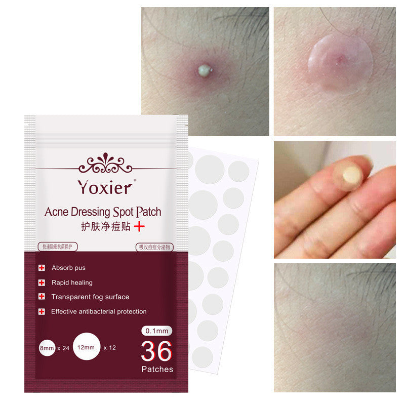 Blemish Treatment Invisible Acne Stickers Pimple Remover Set Face Cream