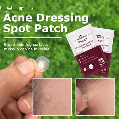Blemish Treatment Invisible Acne Stickers Pimple Remover Set Face Cream